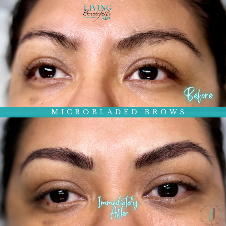 Microbladed AM