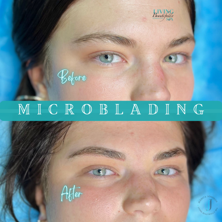 Microblading Abbey B & A-2