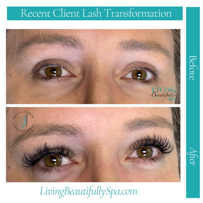 erica lash before and after